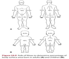 <p>Estimates burn surface area based on body regions.</p>