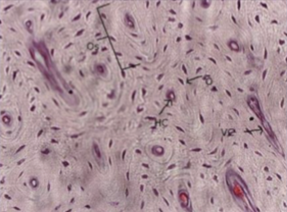 <p>What type of bone is this?</p>