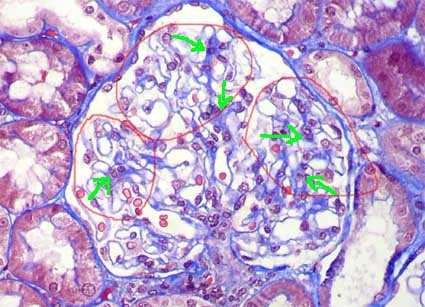 <p>Según la histología normal del glomérulo renal, ¿qué característica <strong>además de ser soporte</strong> tiene la célula señalada?</p>
