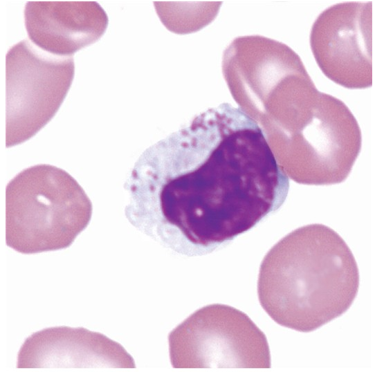 <p>what is a large granular lymphocyte?</p>