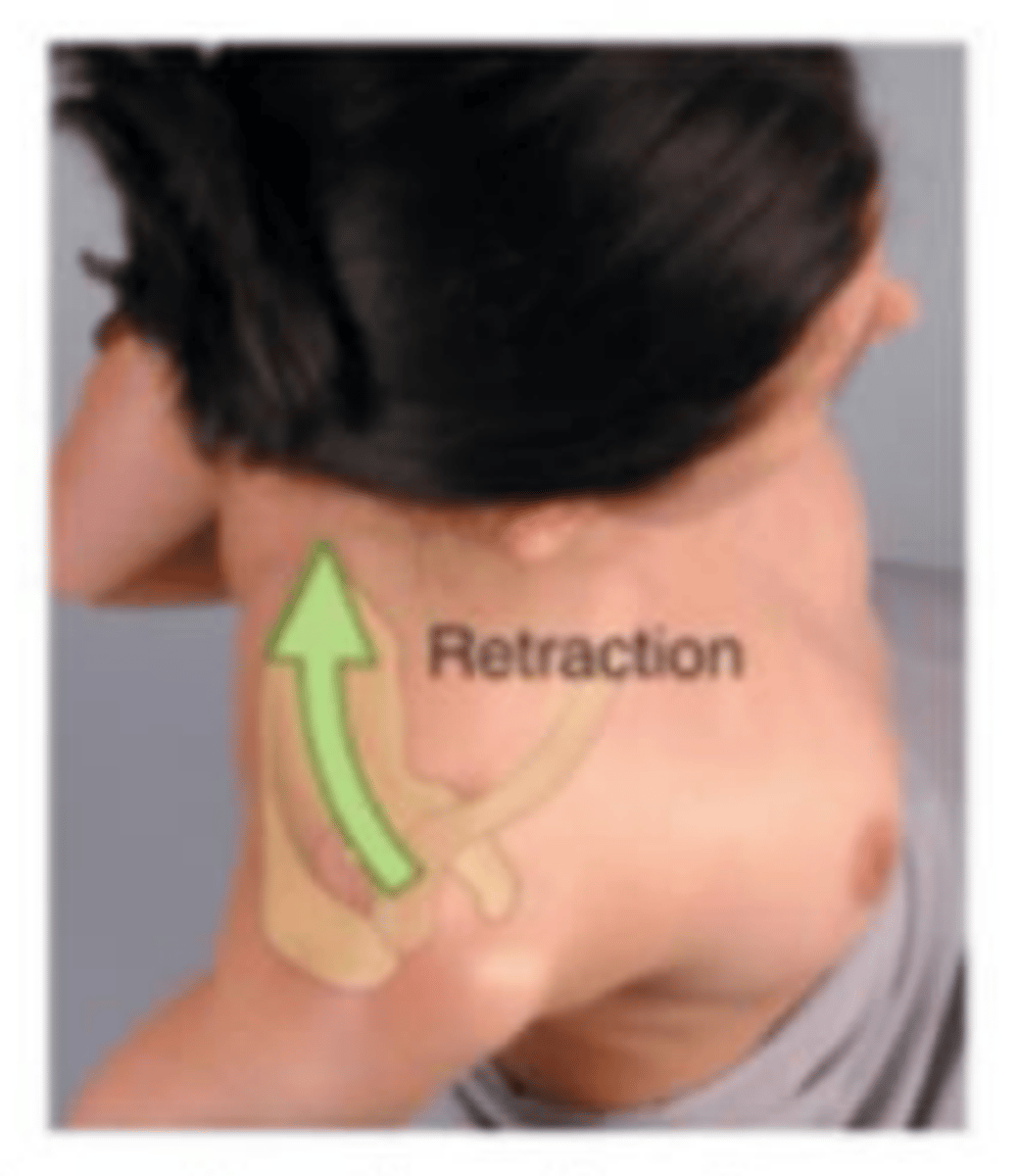 <p>moving scapula on thoracic wall backwards</p>