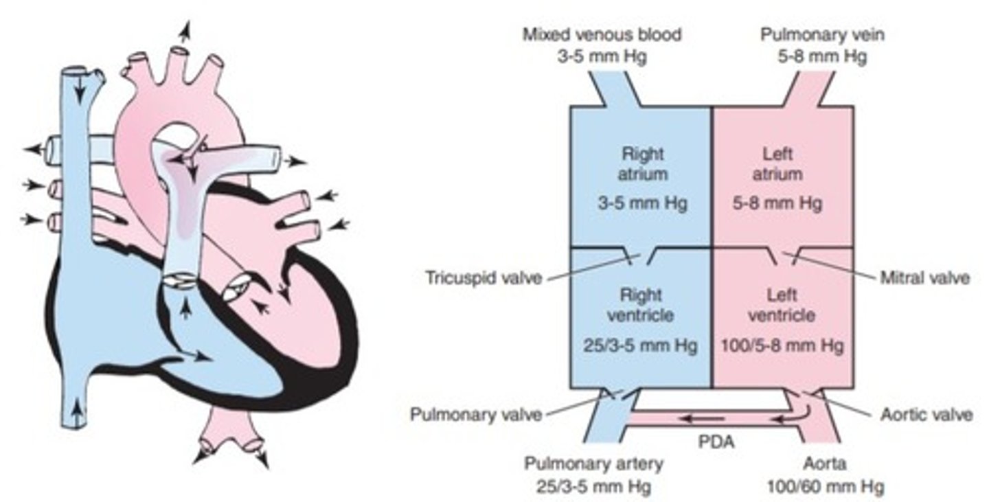 <p>a. Atrial septal defect</p><p>b. Hypoplastic left ventricular syndrome</p><p>c. Patent ductus arteriosus</p><p>d. Atrioventricular canal defect</p>