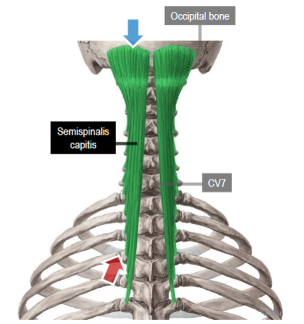 <p>Origin: transverse processes of lower CVs and upper TVs</p>
