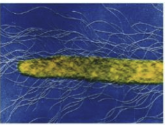 <p>Flagella dispersed all over the surface of the cell.</p>