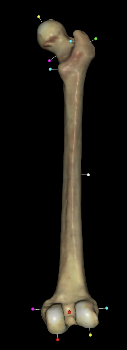 <p>what is the yellow tag on the upper region of the right fermus?</p>