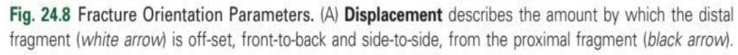 <p>displacement</p>