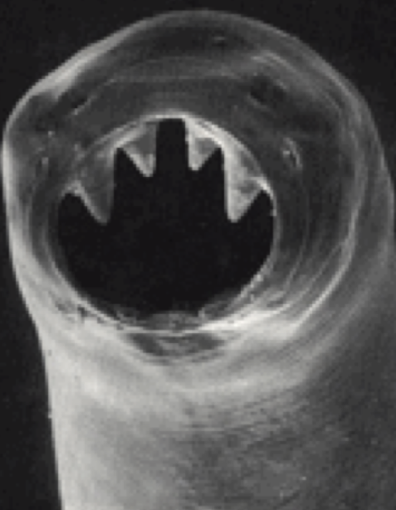 <p>what helminth is this?</p>