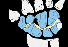 <p>articulation between the proximal row and the distal row of carpal bones, CONVEX ON CONCAVE</p>