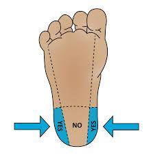 <p>Capillary draws for infants 1-2 years old.</p><p>Using a lancet on plantar surface, in the outside heel area. Either area between big toe to heel, or area between 4th and pinky toe to heel.</p>