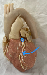 <p>Seen anterior, branch of L coronary artery</p>