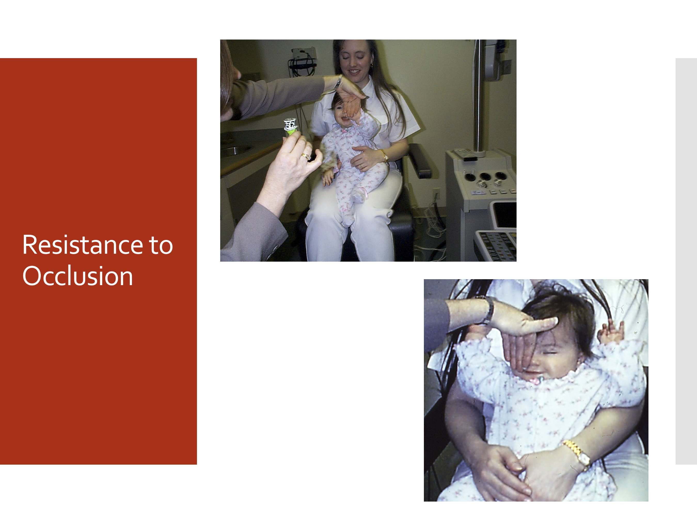 <p>RTO is assessed concurrently with another test of visual ability/acuity while one eye is covered. It is used to look for interocular acuity differences.</p>