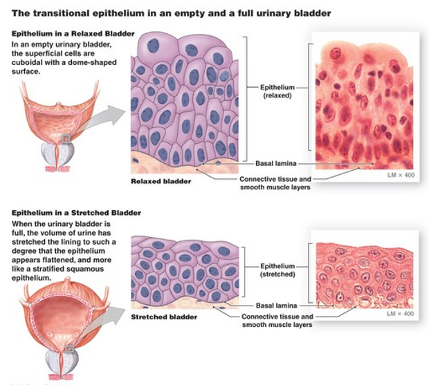 <p><span><strong>1. Bladder wall architecture</strong></span></p><p style="text-align: left;"><span><strong>Smooth muscle layers (detrusor muscle)</strong> → enable contraction for voiding</span></p><p style="text-align: left;"><span><strong>Transitional epithelium (urothelium)</strong> → specialised for stretch</span></p><p style="text-align: left;"><span>Forms <strong>rugae</strong> → allows expansion as bladder fills</span></p><p style="text-align: left;"><span>Helps <strong>accommodate volume without large pressure increase</strong></span></p><p style="text-align: left;"><span>→ prevents <strong>back-pressure on kidneys</strong> and preserves <strong>Glomerular Filtration Rate&nbsp;</strong></span></p><p style="text-align: left;"></p><p style="text-align: left;"><span><strong>2. Sphincters and outlet control</strong></span></p><p><span>•<strong>Internal urethral sphincter (IUS)</strong></span></p><p><span>•Thickened smooth muscle at bladder neck</span></p><p><span>•<strong>Involuntary control</strong></span></p><p><span>•<strong>External urethral sphincter (EUS)</strong></span></p><p><span>•Striated muscle</span></p><p><span>•<strong>Voluntary control</strong></span></p><p></p><p><span><strong>3. Innervation (overview)</strong></span></p><p><span>•Controlled by the <strong>autonomic nervous system</strong> (details later lecture)</span></p><p><span>•Coordinates <strong>storage vs voiding phases</strong></span></p><p style="text-align: left;"></p><p style="text-align: left;"><span><strong>4. Ureter–bladder interface</strong></span></p><p><span>•Ureters pass through the <strong>detrusor muscle at the trigone</strong></span></p><p><span>•Entry supports <strong>one-way flow into bladder</strong> (anti-reflux mechanism)</span></p><p></p><p><span><strong>5. Sensory function</strong></span></p><p><span>•Bladder wall contains <strong>stretch-sensitive receptors</strong></span></p><p><span>•Detect filling → initiate micturition reflex</span></p><p style="text-align: left;"></p><p style="text-align: left;"><span><strong>6. Clinical/functional relevance</strong></span></p><p><span>•<strong>Bladder position varies with filling state</strong> → important during examination</span></p><p><span>•Proper compliance prevents:</span></p><p><span>•↑ pressure transmission to kidneys</span></p><p><span>•↓ renal function (GFR compromise)</span></p>