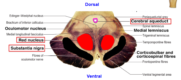 <p>horizontal section of the midbrain</p>