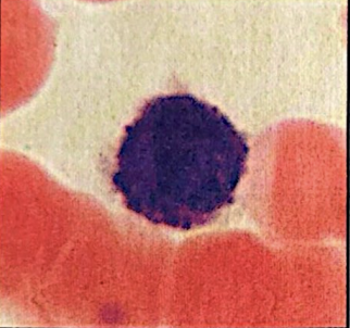 <p>basophils (granulocyte) </p>