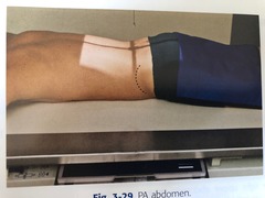 <p>CR and IR to iliac crest</p>