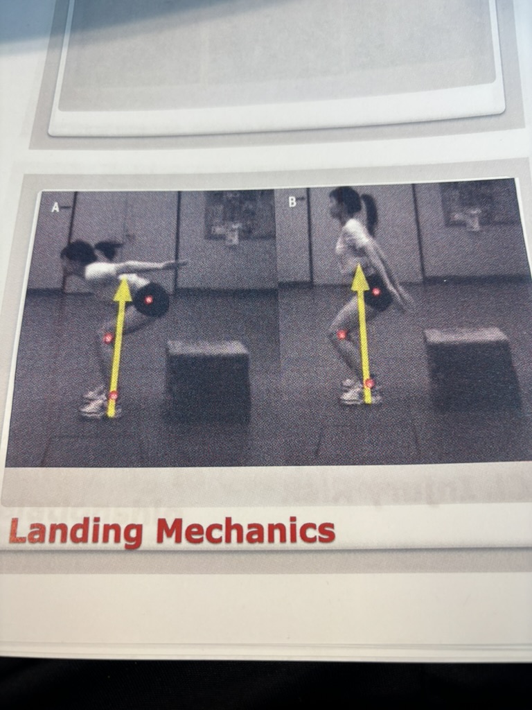 <p>- A) Uses more glute max, glute min. Recovering from knee injury</p><p>- B) recovering from labral tear. Uses less hip and more knee</p>