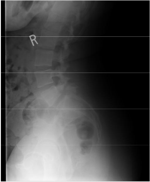 <p>Fix this image (Lateral Lumbar)</p>