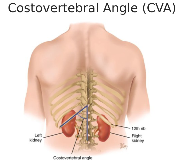 <p>blunt percussion: costovertebral anlge, fingertip pressure is enough, pt will feel a perceptable but PAINLESS thud </p>
