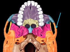 <p>cheek bone</p>