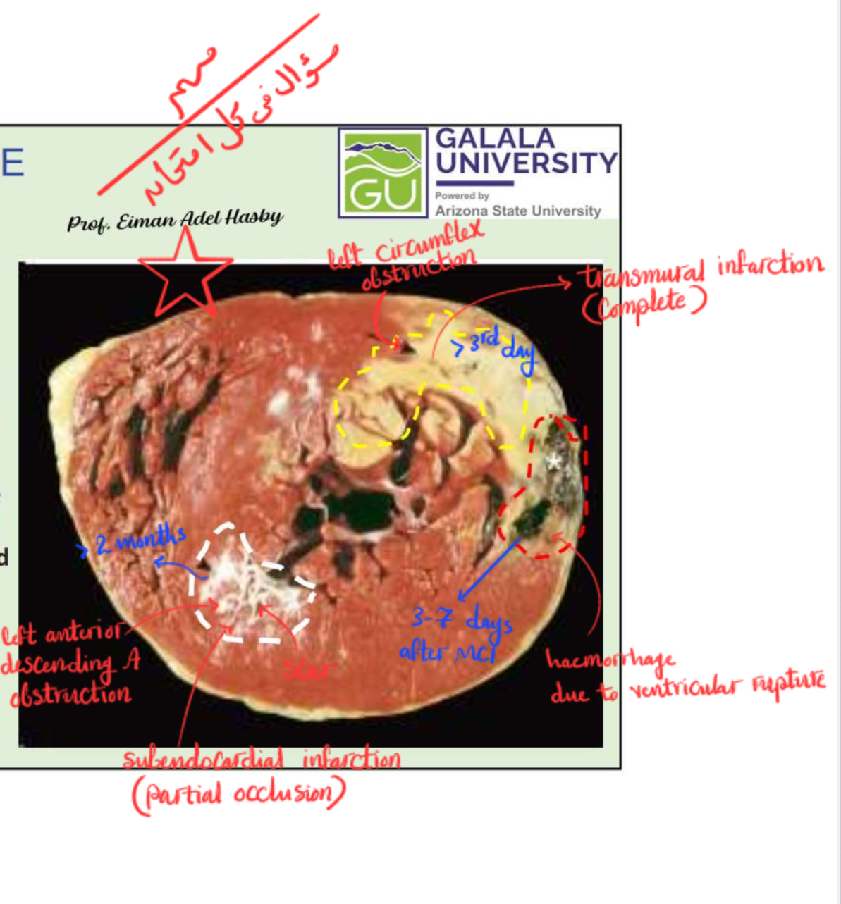 term image