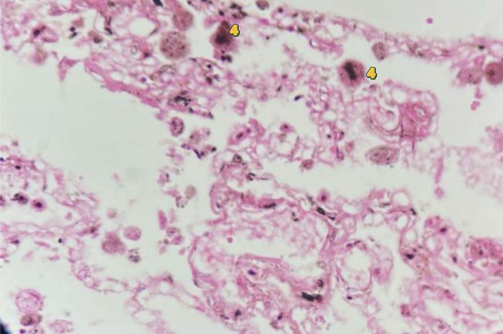 <p>diagnose & identify pointed structure</p>