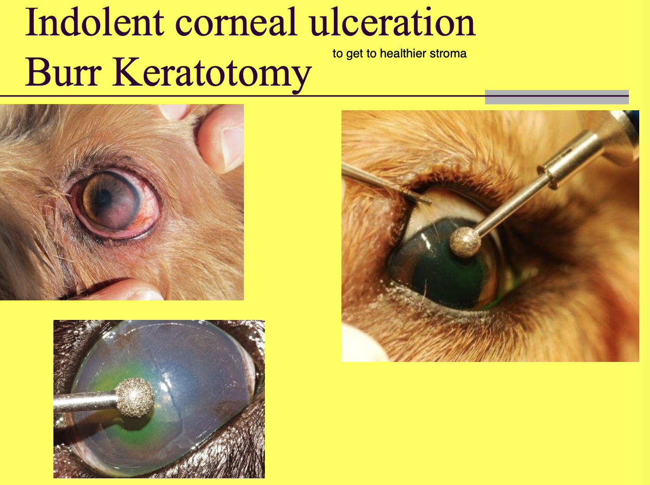 <p>do not do if the ulcer is infected.</p><p>goal is to expose underlying healthy stroma to allow for healing.</p>