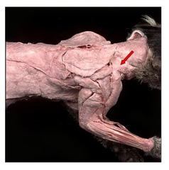 <p>muscle that works together with the clavobrachialis in the forward extension of the humerus (running) and assists in turning the head and flexing the elbow</p>