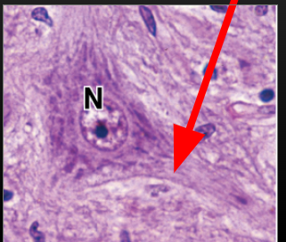 <ul><li><p>large, euchromatic nucleus. large nucleolus</p></li><li><p>lots of nissil substance</p></li><li><p>Axon hillox (red arrow)- transition between axon and soma. where nissl substance stops.</p></li></ul><p></p>