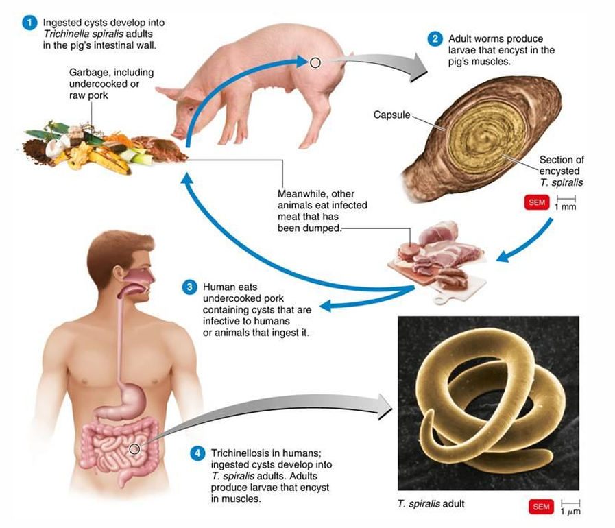 <p>Pathogen → Trichinella spiralis, T. nativa</p><p>Symptoms → Larvae encyst in striated muscle; usually few symptoms, but large infections may be fatal (Fever, eye swelling, gastrointestinal upset)</p><p>Intermediate &amp; definitive hosts → mammals\</p><p>Diagnostic test → Biopsy; ELISA</p><p>Treatment → Mebendazole; corticosteroids</p>
