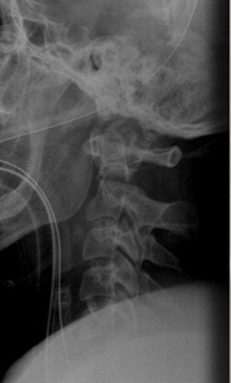 <p>What is the diagnosis?</p>