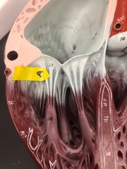 <p>Identify these structures.</p>