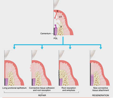 <p>-cell type that repopulates an exposed root surface</p>