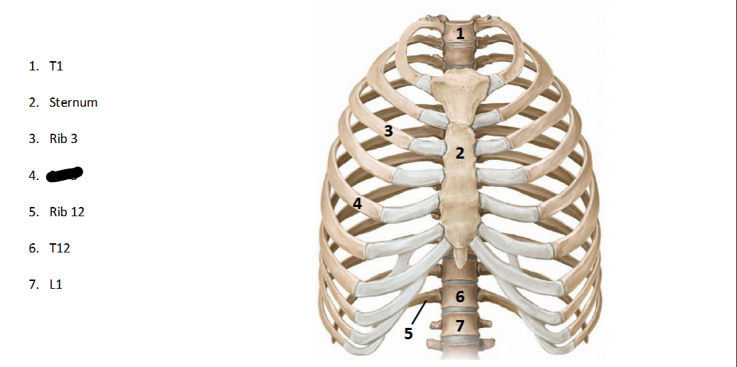 <p>What structure is this within the <strong>Spine? (ANTERIOR OF AXIAL)</strong></p>