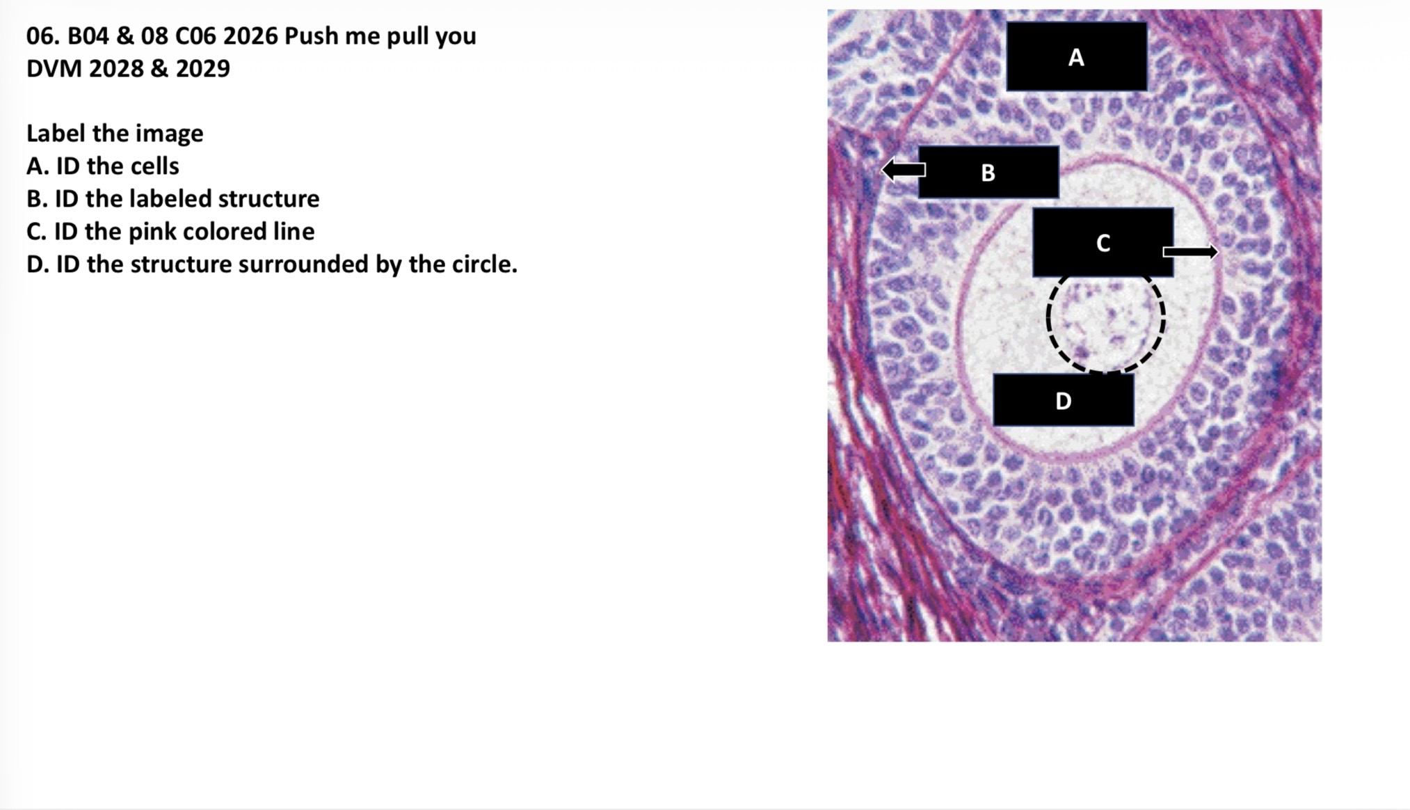 <p>A. Granulosa cells</p><p>B. Basement membrane </p><p>C. Zona pellucida</p><p>D. Oocyte nucleus </p>