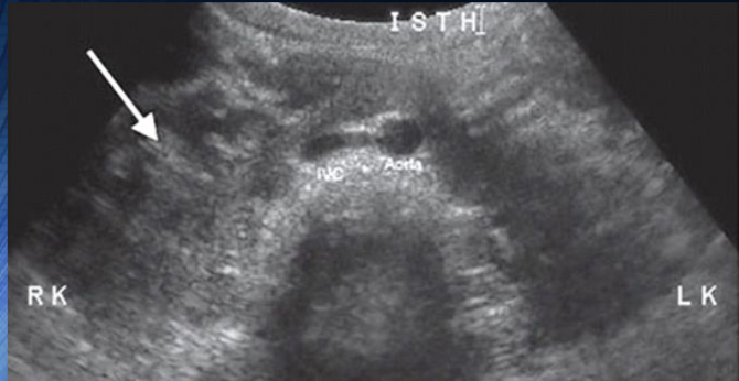 <p>What is this?</p>