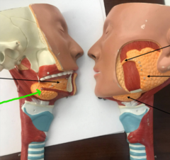 <p>What structure is the green arrow pointing to?</p>