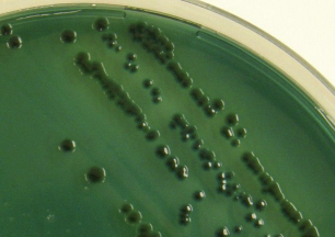 <p>which species of vibrio are alkaline on TCBS (green/blue)?</p>