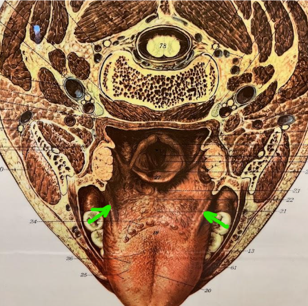term image
