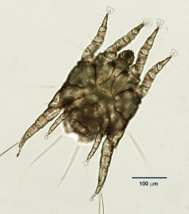 <ul><li><p>name</p></li><li><p>host (hint: cats)</p></li><li><p>infection site</p></li><li><p>diseases transmitted</p></li></ul><p></p>