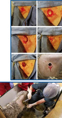<p>What treatments can you do for tetanus BESIDES tetanus antitoxin and tetanus toxoid</p>