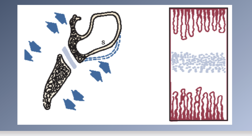 <p><span>CRANIAL BASE</span><br><span>1. Formed initially in cartilage à endochondral ossification à</span><br><span>bone</span><br><span>2. MIDLINE STRUCTURES</span><br><span>3. CENTRES OF OSSIFICATION early in embryonic life in the chondro-cranium (basioccipital, sphenoid, ethmoid bones)</span><br><span>4. SYNCHONDROSES remain between the centres as ossification proceeds</span><br><span>5. Inmovable joints</span></p><p><span>5. SYNCHONDROSES: two-sided epiphyseal plate</span><br><span>1. Area of cellular hyperplasia in the center</span><br><span>2. Bands of maturing cartilage cells extending in both directions</span><br><span>3. Mature cartilage is eventually replaced by bone</span></p>