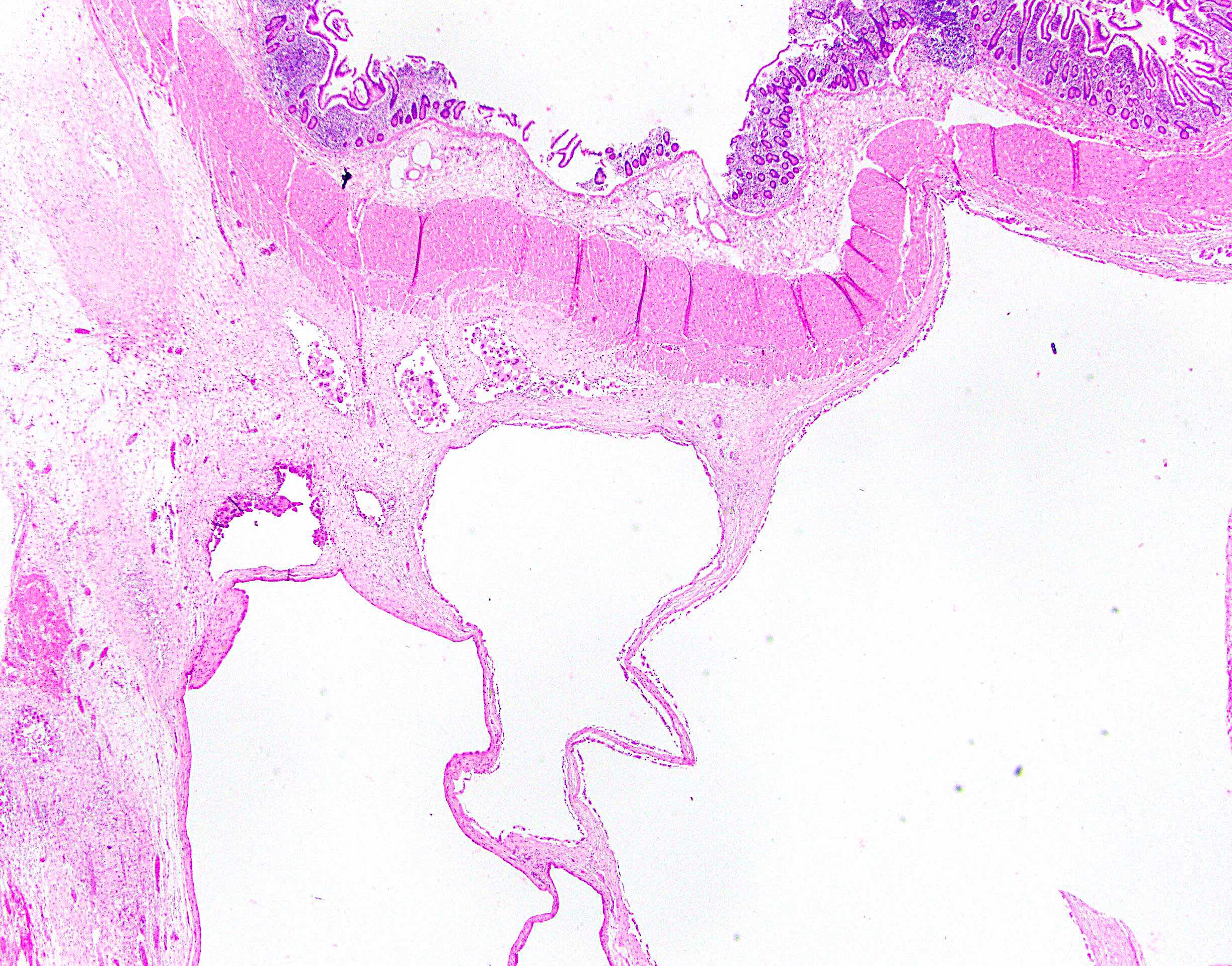 <p>Diagnostic</p>