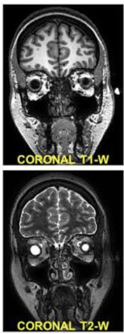 <p>From the front facing the patient</p>