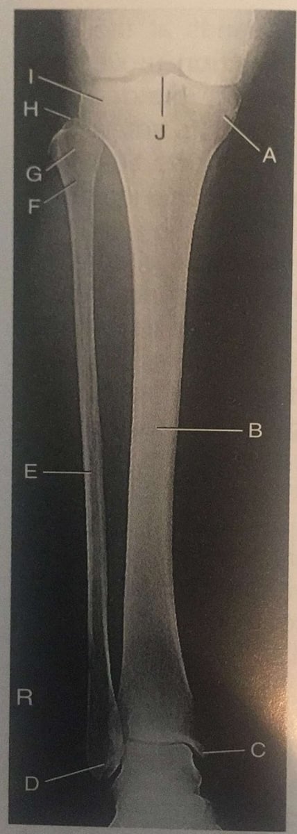 <p>A</p>
