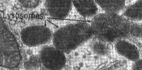 <p>Organellen gevormd door het Golgi-apparaat (en onrechtstreeks het R.E.R.). Functie: afbraak van macromoleculen tot bouwstenen ("de maag van de cel"). Bevatten hydrolytische enzymen (proteasen, nucleasen, lipasen, glycosidasen, enz.) met een zuur pH-optimum. De zure inhoud wordt onderhouden door protonpompen in het membraan (ATP-verbruik). Vrijgekomen bouwstenen gaan naar het cytoplasma voor hergebruik. Primaire lysosomen = nog niet actief, afkomstig van Golgi. Secundaire lysosomen = actief bezig met vertering, herkenbaar op E.M. aan dense, onregelmatige inhoud</p>