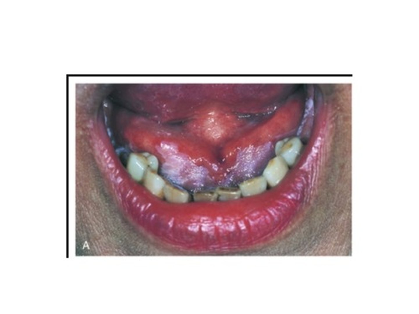 knowt flashcard image