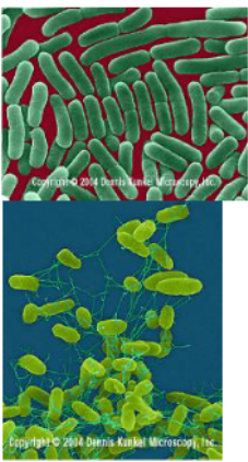 <p><strong>Salmonellosis</strong></p><p>Causative agent <strong><mark data-color="purple" style="background-color: purple; color: inherit;">[__]</mark></strong>: <mark data-color="yellow" style="background-color: yellow; color: inherit;">motile, Gram-negative rods</mark></p><p><mark data-color="#f4eeee" style="background-color: rgb(244, 238, 238); color: inherit;">high infectious dose</mark> due to its high sensitivity to stomach acid</p>
