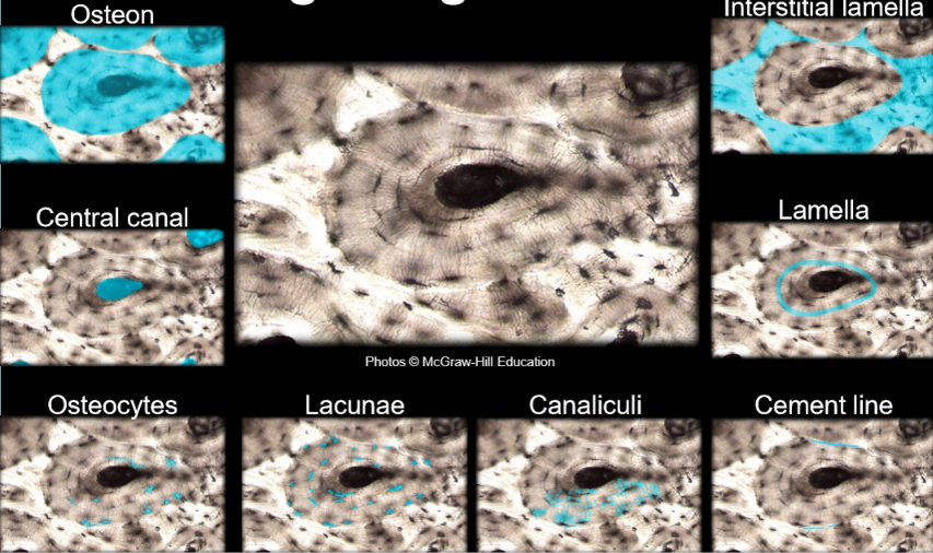 <ol><li><p>outer shell of long bones; lacunae, osteons(main structural unit), dense.</p></li></ol><p></p>