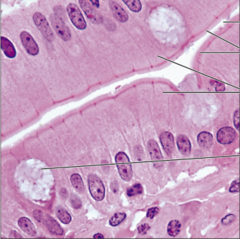 <p>name the tissue: singe layer of tall cells with round to oval nuclei; many cells bear microvilli; some bear cilia; contains goblet cells</p>