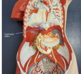<p>esophageal hiatus</p>